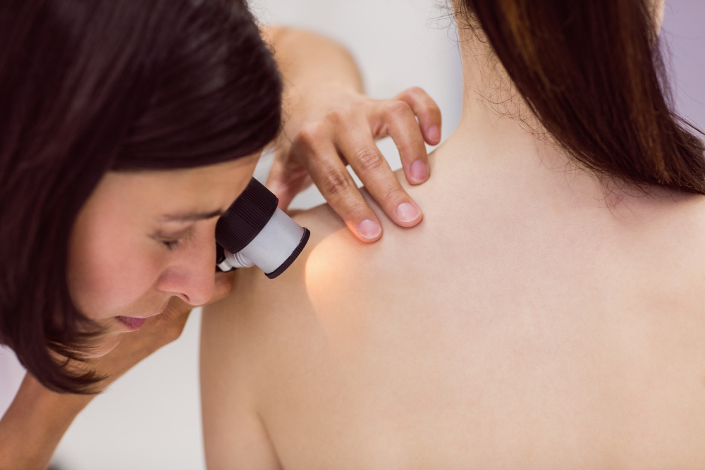 dermatolozka kontroluje kozni znamenka dermatoskopem